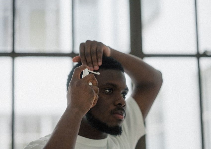 Minoxidil: A Treatment Option For Everybody?