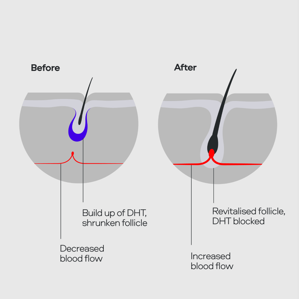Advanced Plan - Capsule